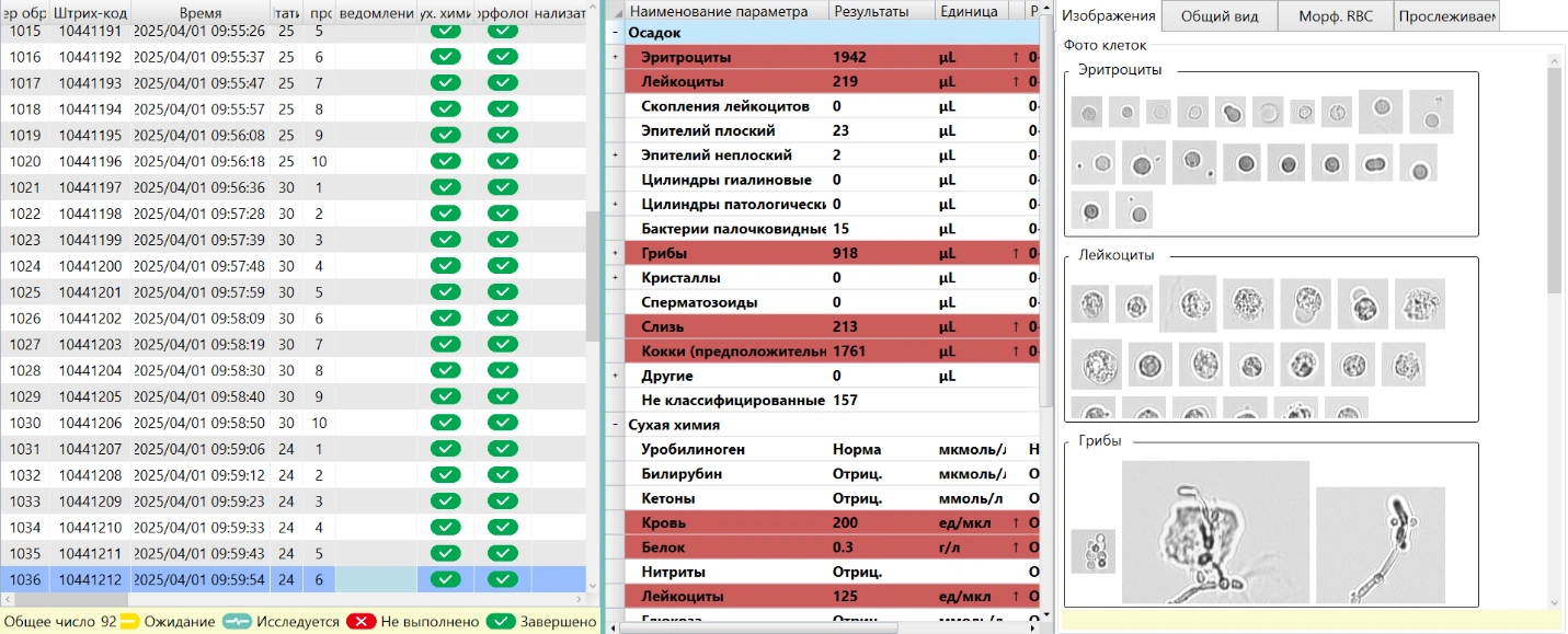 Интерфейс анализатора: рабочий список образцов, список результатов, область просмотра изображений